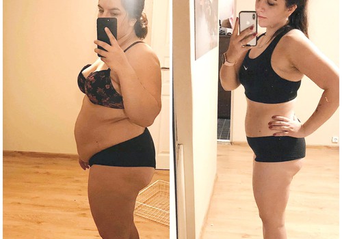 Raqueli blogi: kuidas ma mäovähendusoperatsiooniga 28 kilo kaotasin