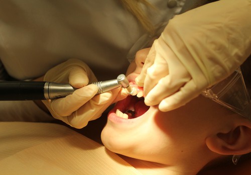 Kooli minev laps peaks külastama ortodonti