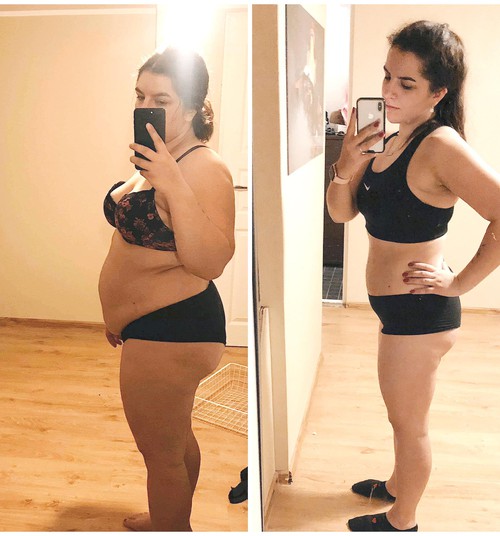 Raqueli blogi: kuidas ma mäovähendusoperatsiooniga 28 kilo kaotasin