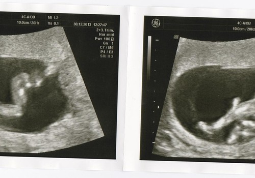 Kati raseduse blogi: 14. nädal: 30.12-05.01